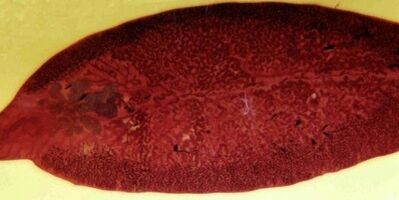 parásito trematodo cómo eliminar del cuerpo